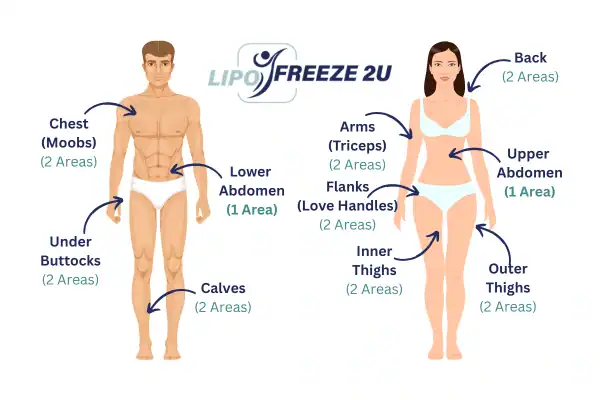 Areas you can have fat freezing treatment Marlow