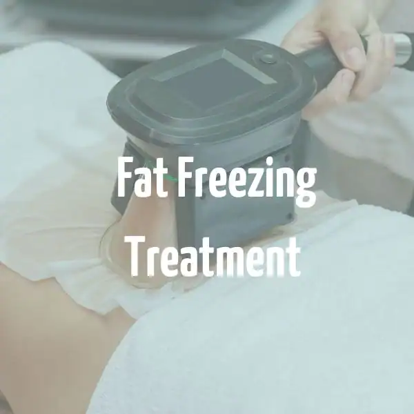 fat freezing treatment Marlow