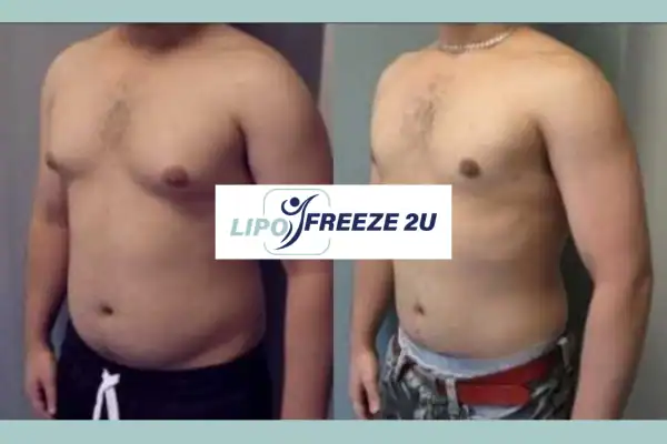 How Long Does It Take to See Results Marlow?