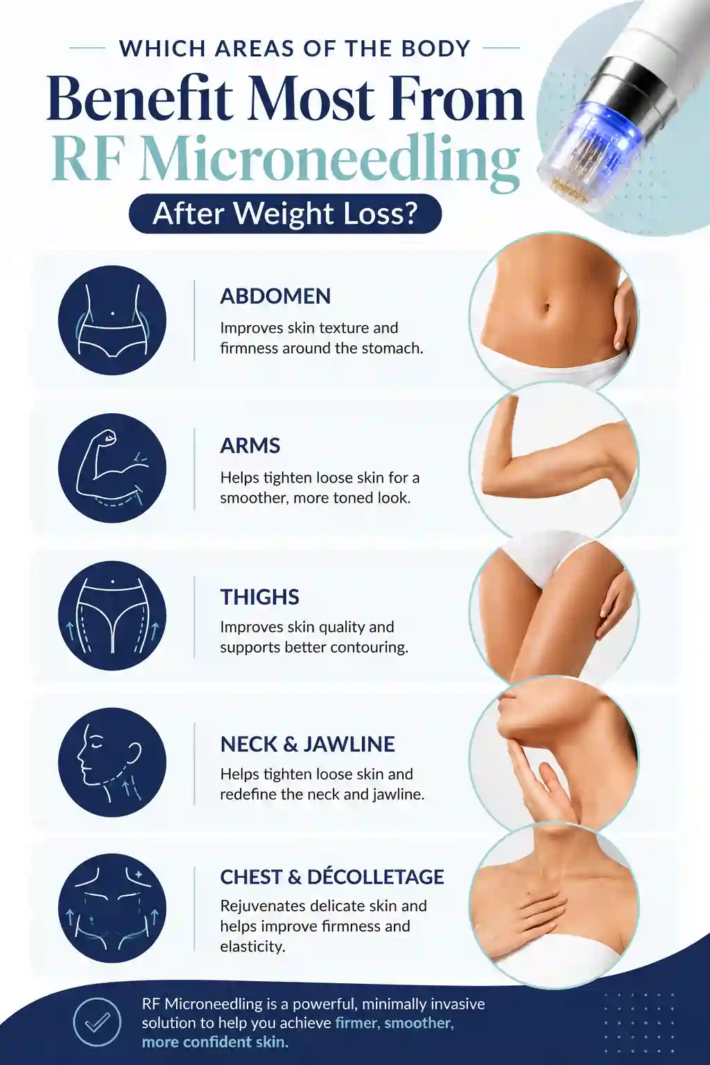 Which Areas of the Body Benefit Most From RF Microneedling After Weight Loss Marlow