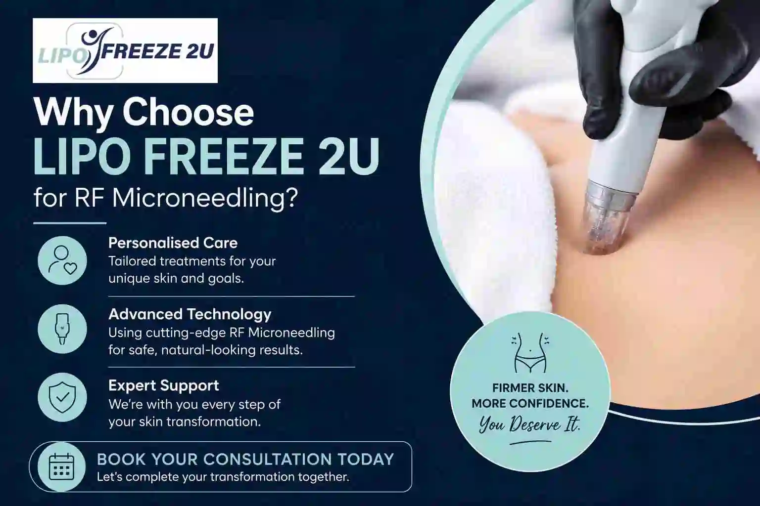 Why Choose LIPO FREEZE 2U for RF Microneedling Marlow?